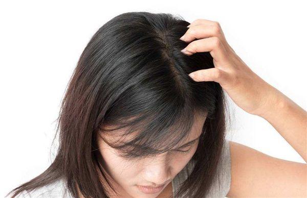 丰盈蓬松的洗发水适合油性头发吗 有什么好的防脱发洗发水？